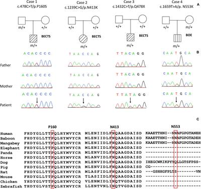 Heterozygous PGM3 Variants Are Associated With Idiopathic Focal Epilepsy With Incomplete Penetrance